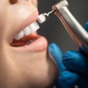 Dental Cleaning