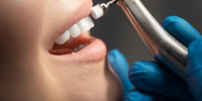 Dental Cleaning