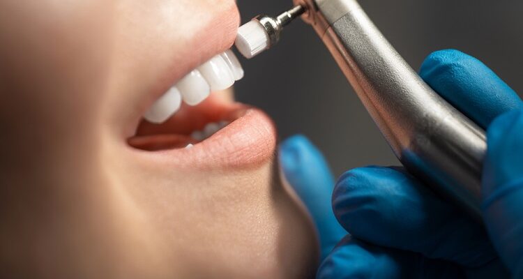 The Essential Guide to Dental Cleaning: Unlocking the Secrets of a Healthy Smile Dental Cleaning